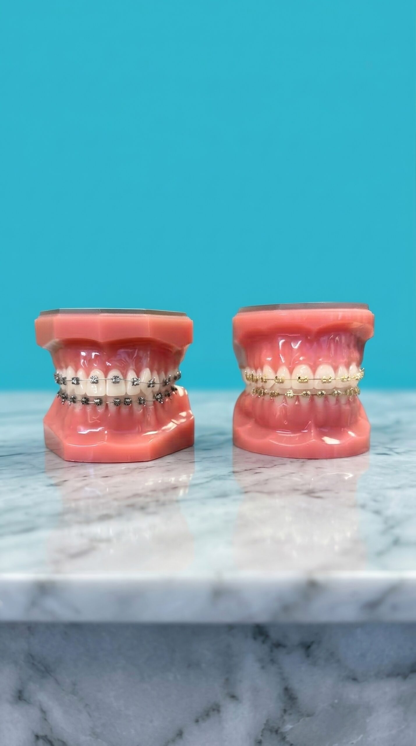 Silver metal braces and Iconix gold champagne braces side by side on dental models at Murray Orthodontics in Palm Beach Gardens, FL