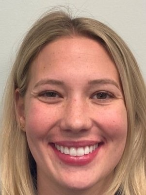 Same patient after clear aligners, smiling with a broader smile that shows more teeth toward the corners