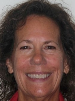 Adult patient smiling after clear aligner treatment closed her severe open bite without surgery